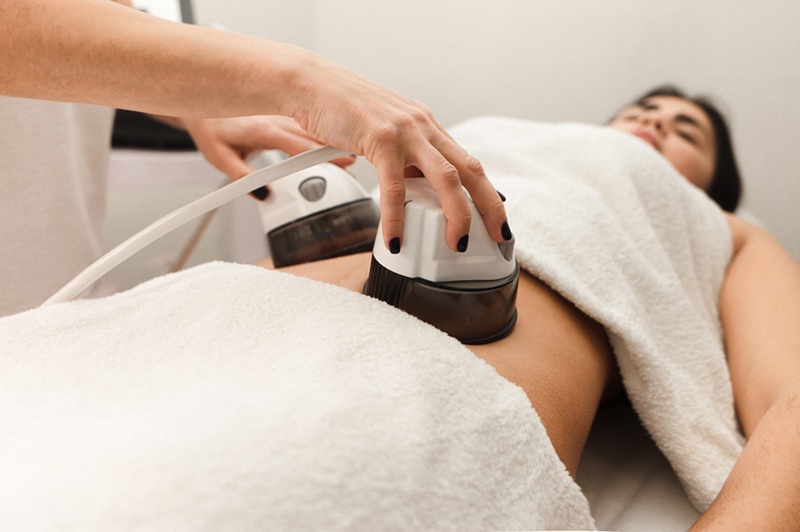 The procedure for vacuum anti-cellulite massage of the abdomen in a cosmetology clinic